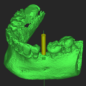 CAD / CAM